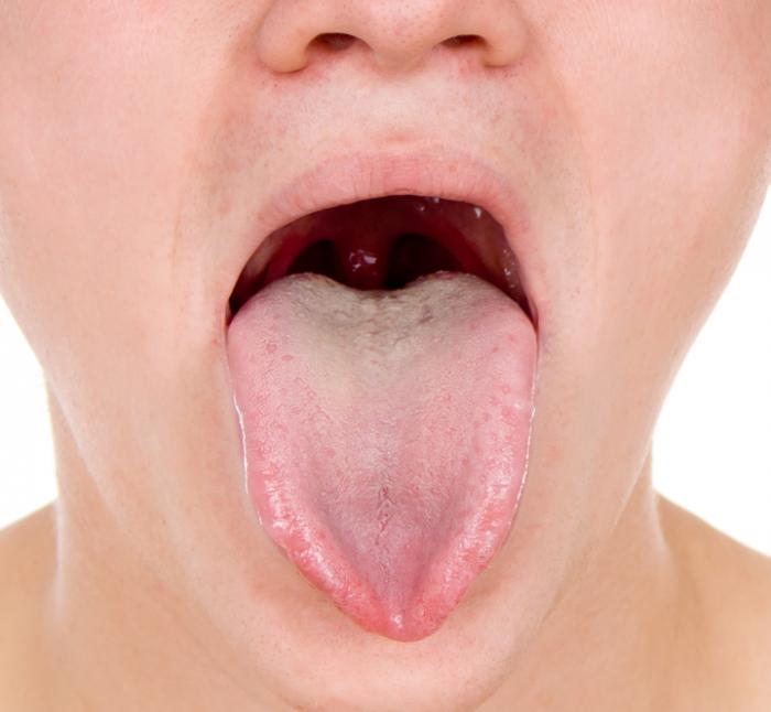 What is the flap of skin that is under a person's tongue?