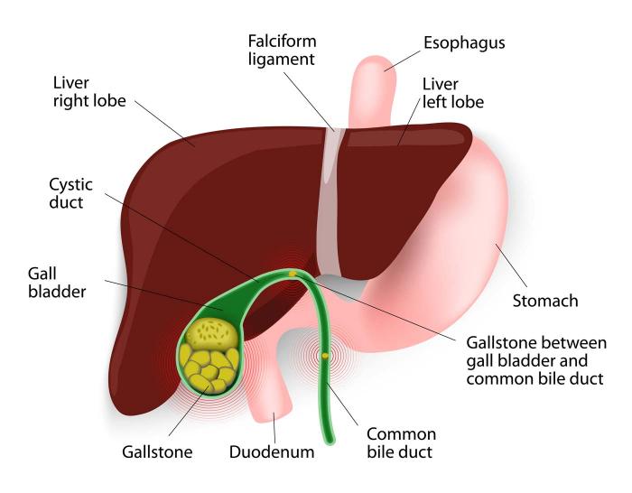How does a HIDA scan work to diagnose gallbladder problems?