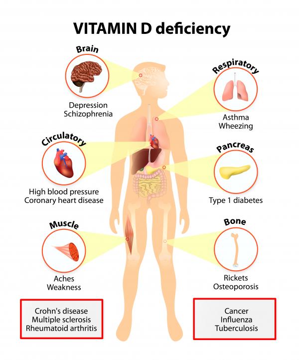 What are the side effects of low vitamin D levels?