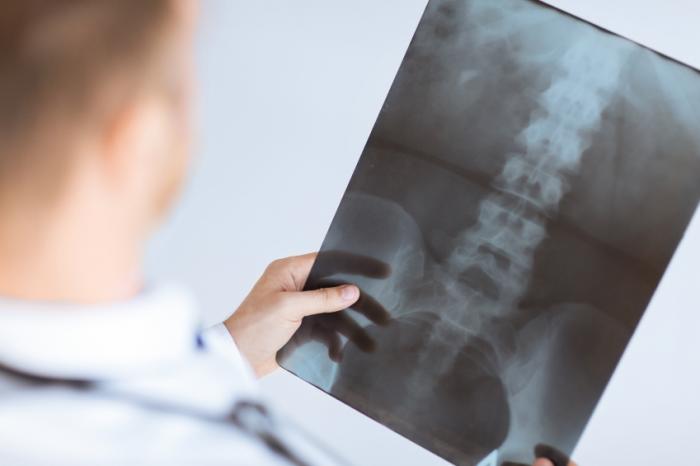 What signs and symptoms indicate dpotential spondylitis?