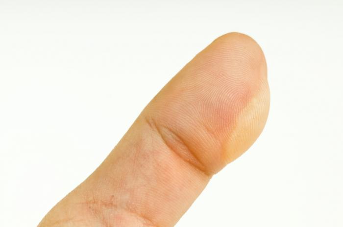 blister on finger #10