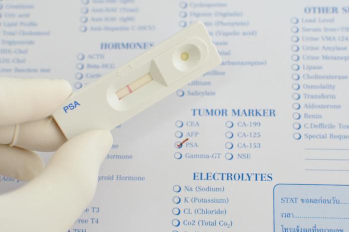 What are the current PSA testing guidelines?