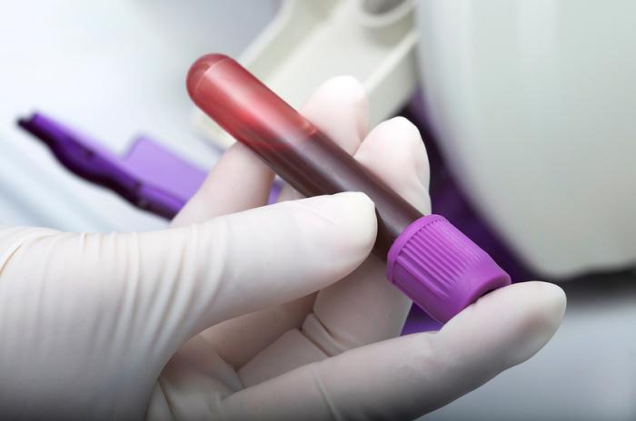 How are blood levels measured?
