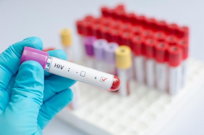 What are some major articles about HIV and AIDS?