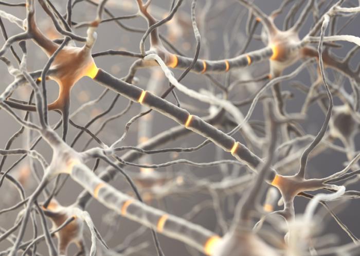 Alzheimer's disease: Molecular study clarifies potential link to high blood sugar - Medical News Today