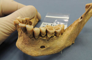 A set of ancient teeth