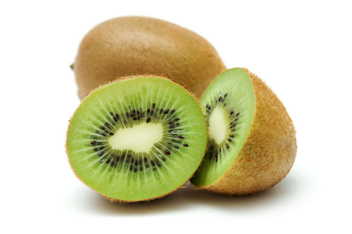 A selection of kiwifruit