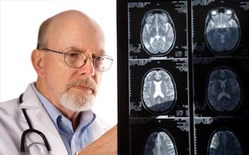 A doctor examining brain scans