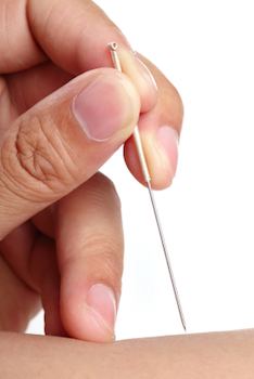 Acupuncture needle being touched to skin.