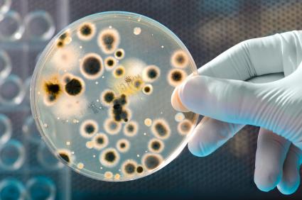 bacteria in a petri dish
