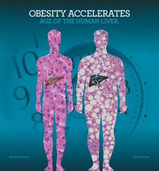 Obesity accelerates liver aging