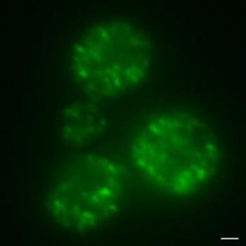 [Yeast Cells with GFP and Amyloids]