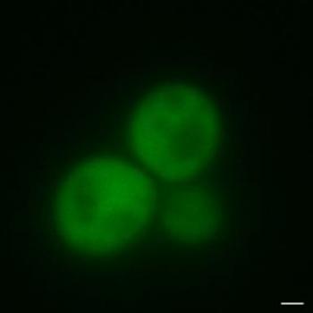 [Yeast Cells with GFP and Non-amyloid Prion protein]
