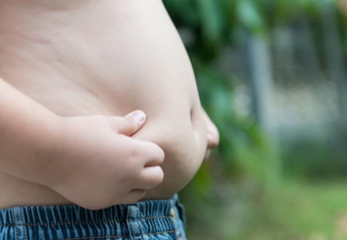 obese child's stomach