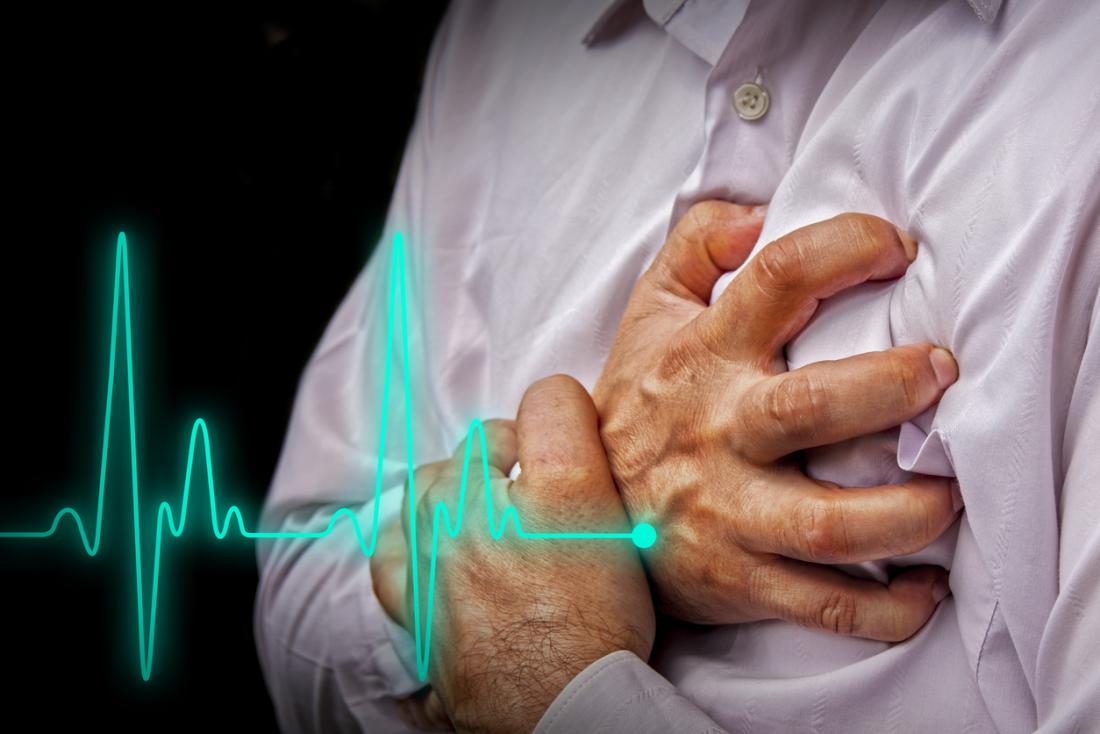 heart attack: causes, symptoms, and treatments
