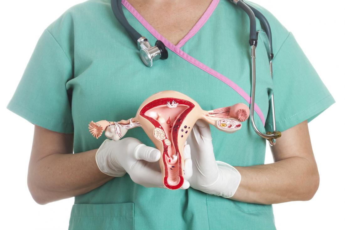 polycystic ovary syndrome, Type 2 diabetes risk four times higher in women with PCOS