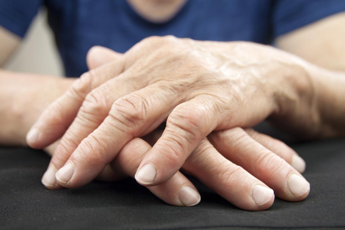 rheumatoid arthritis, Rheumatoid arthritis could be treated with a novel hydrogel