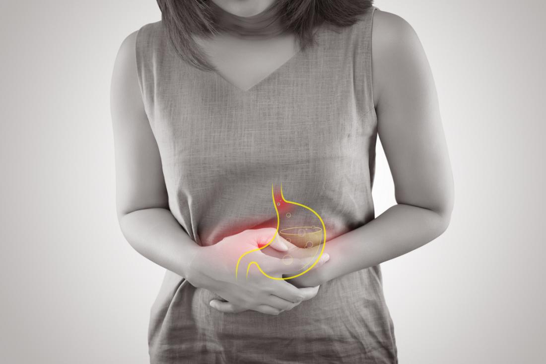stomach cancer, Common acid reflux drug increases stomach cancer risk